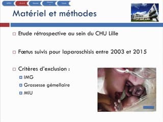 FAUT IL PROGRAMMER LA NAISSANCE DES ENFANTS PORTEURS D’UN LAPAROSCHISIS AUX HEURES OUVRABLES ?