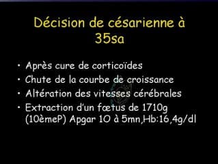 Thrombose d'un chorio-angiome