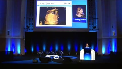 Staffs de dossiers : dossiers poumon ? Séquestration