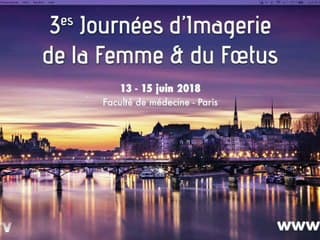 L’échoguidage au bloc opératoire en gynécologie › Gimmick ou nécessité absolue au bloc opératoire ?