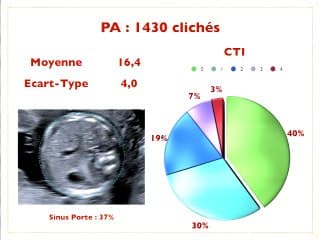 Comment évaluer sa pratique échographique de biométrie et de doppler