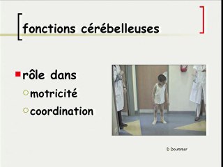 5 Pathologies du cerveau foetal fosse post