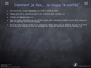 POSTER Coupe 4 cavités