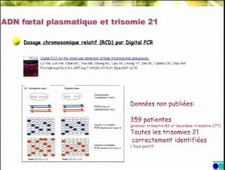 Diagnostic prénatal non invasif de la trisomie 21 : où en est-on ?