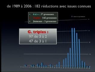 Réduction embryonnaire : réduction en cas de grossesse triple