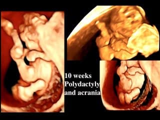 Comment améliorer sa pratique échographique ?