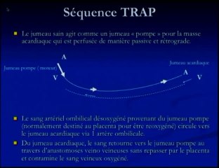 Séquence TRAP