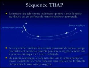 Séquence TRAP