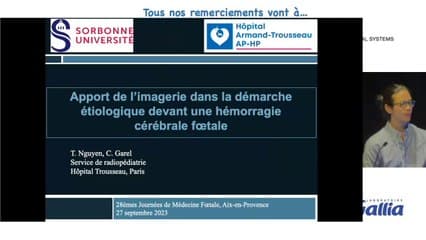 Apport de l’imagerie dans la démarche étiologique devant une hémorragie cérébrale fœtale