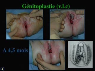Ambiguités sexuelles