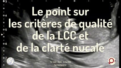 Les critères de qualité de la LCC et de la clarté nucale
