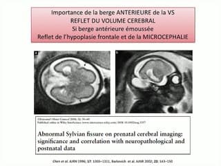 Une nouvelle boite à outils pour élucider une réduction du PC.