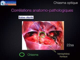 Images de demain ou d'aujourd'hui ?