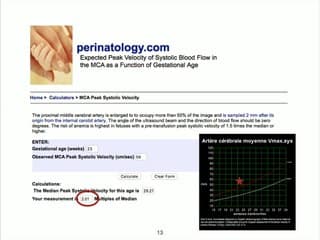 Staff : infections materno-foetales Parvovirus