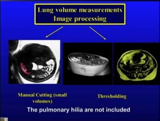 Hernie diaphragmatique : Apport de l'IRM
