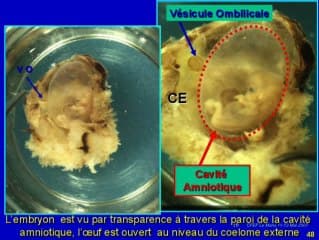 Les annexes : rappel embryologique et images normales au 1er trimestre