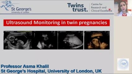 GROSSESSES GEMELLAIRES: Pour une meilleure gestion échographique VF
