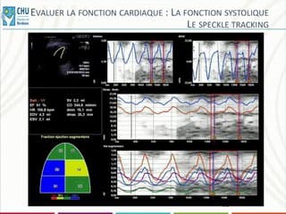 Coeur foetal II : c’est trop gros ! Surveillance et pronostic des gros coeurs par gros débits
