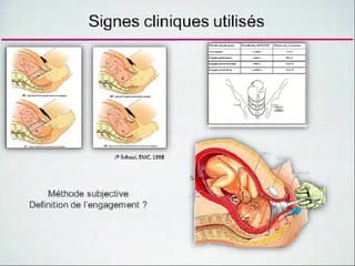 Techniques d'examen en salle de naissance