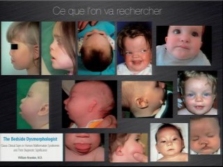Nouvelles techniques 3D et exploration de la face.