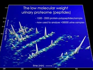 L'utilisation de l'omique en diagnostic prénatal.