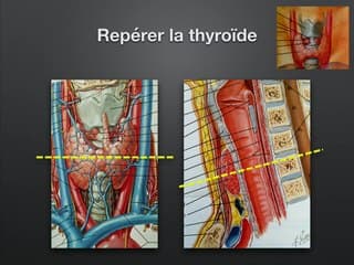Surveillance foetale et dysfonction thyroïdienne maternelle