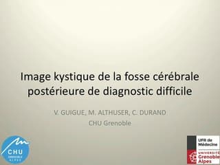 Image kystique de la fosse postérieure de diagnostic difficile.