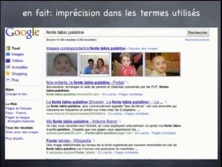 Impacts de l’échographie 3D dans la prise en charge prénatale des fentes du palais primaire et secondaire