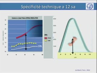 Le coeur foetal au 1er trimestre pour tous