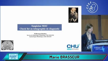 Il y a un os ! La check-list optimale en échographie de diagnostic en cas de suspicion de MOC