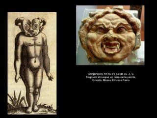 La représentation des malformations faciales dans l’art occidental