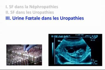 L’étude de la fonction rénale foetale : que reste-t’il des indications?