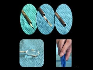 Développement d’un ballon à ouverture magnétique pour l’occlusion trachéale par endoscopie.