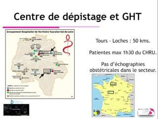 Le 1er trimestre Centre de dépistage des risques au 1er trimestre : expérience tourangelle au sein des GHT