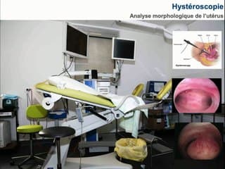 "Le One Day Global Fertility AssessmentSérologie, dosages hormonaux, échographie, hystéroscopie, spermogrammeRéunion de conseil"