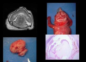 IRM post mortem  ( en ANGLAIS )