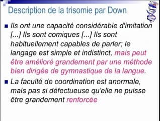 Histoire de la Trisomie 21