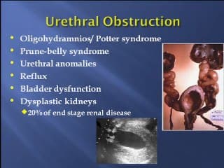 rein foetal  ( en ANGLAIS )