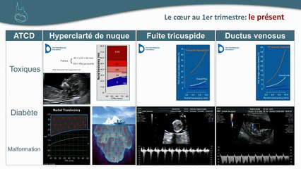 Le coeur foetal au 1er TRIMESTRE. Accessible à tous ? Souhaitable pour tous ?