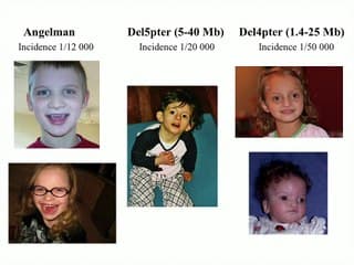 Pour ou contre la recherche de microdélétions foetales sur analyse de l'ADN foetal dans la circulation maternelle :