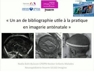 Un an de bibliographie utile à la pratique en échographie anténatale ? Imagerie du cerveau