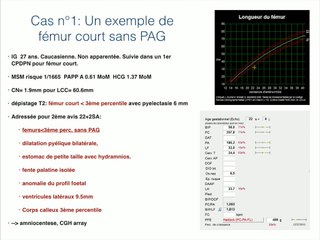 Erreurs d'experts  Imagerie du squelette