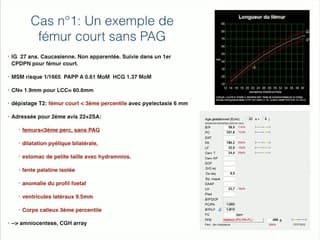 Erreurs d'experts  Imagerie du squelette