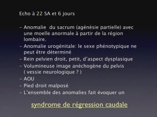 Un dossier de moelle / basse, lipome...