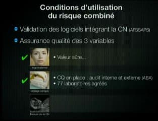 Dépistage de trisomie 21 calcul de risque intégré