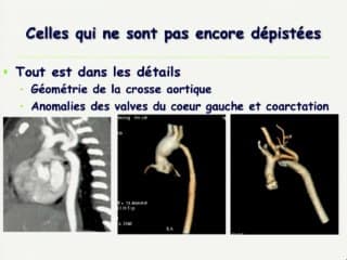 Les cardiopathies dont on ne parle jamais
