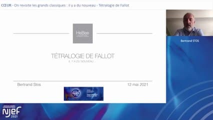 Cœur, on revisite les classiques: Tétralogie de Fallot