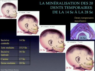 Flash innovation : les dents fœtales et le diagnostic des anomalies dentaires (dysplasies ectodermiques).
