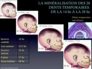 Flash innovation : les dents fœtales et le diagnostic des anomalies dentaires (dysplasies ectodermiques).