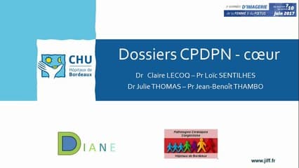 Coeur : Tétralogie de Fallot